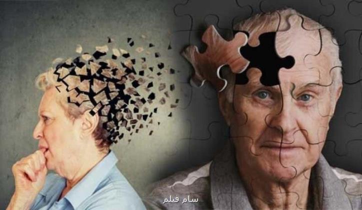 چرا این ۲ سوپراستار هالیوود به زوال عقل گرفتار شدند؟ علت کشف شد